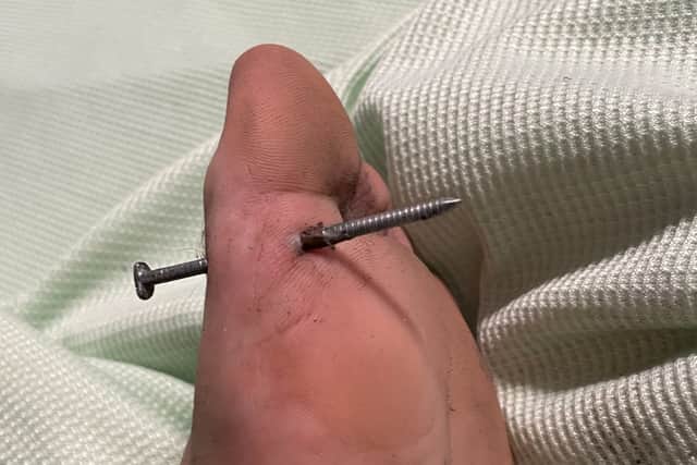 Rob Owen foot with the nail in it. Credit; SWNS/Rob Owen