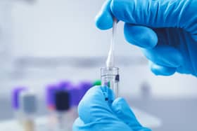 Health chiefs are warning people to be careful after cases of ‘super gonorrhea’ were identified. Photo: AdobeStock