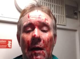 Train driver Ian Birch after his cab window was shattered by a brick at 70mph in Clifton
