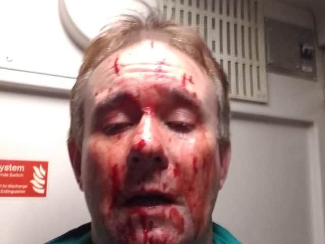 <p>Train driver Ian Birch after his cab window was shattered by a brick at 70mph in Clifton</p>