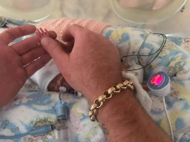 <p>Rob Hampson holding baby Elsie’s tiny hand Credit: Katie Hampson / SWNS</p>