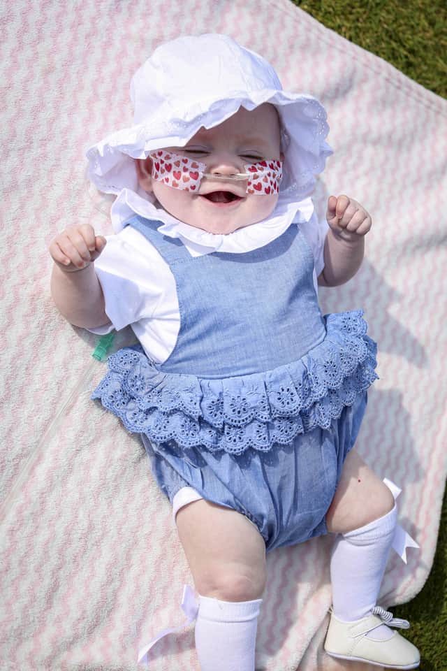 Little Elsie, now eight months Credit: SWNS