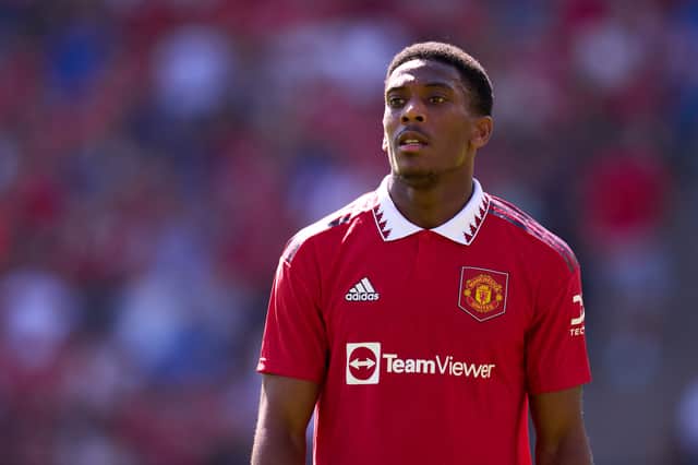 Martial will miss the opening  match of the season through injury. Credit: Getty.