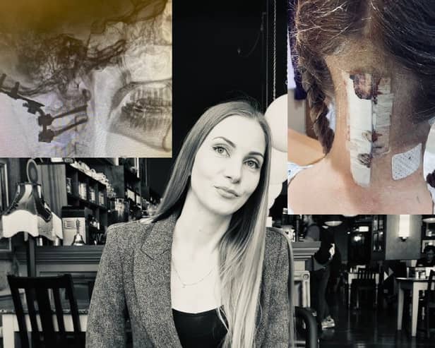 Diana Olijar is fund-raising for surgery on her spinal cord