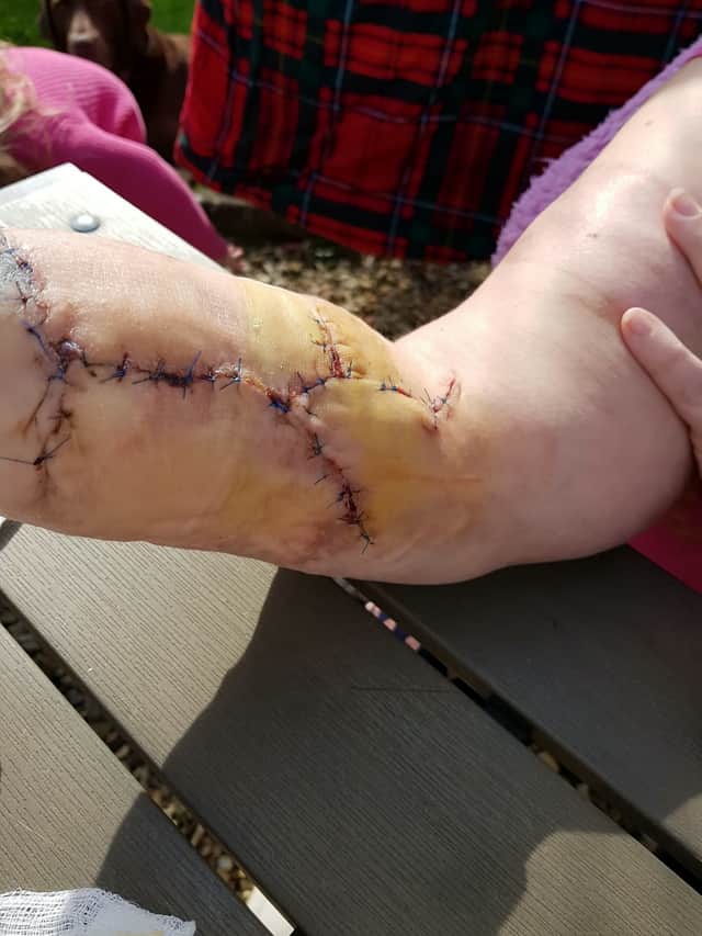 Police have dropped the case but Rachel can’t work and is still receiving treatment for her injuries, and unable to use her right hand properly