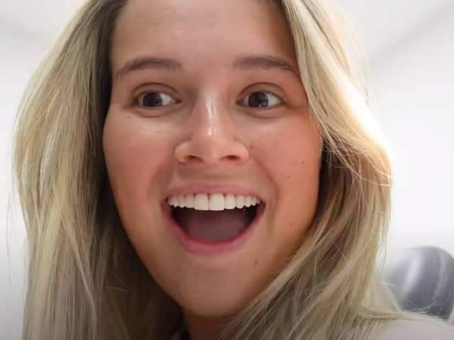 Molly-Mae Hague showing off her new smile.