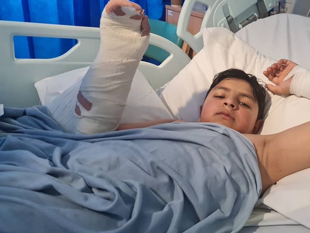 Mohid Gardazee needed over three hours of surgery on his right arm