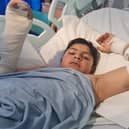Mohid Gardazee needed over three hours of surgery on his right arm