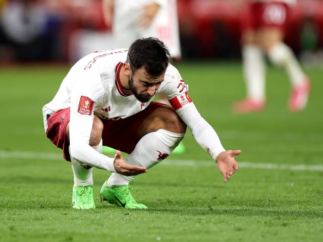 Bruno Fernandes was seen limping after the win over Nottingham Forest