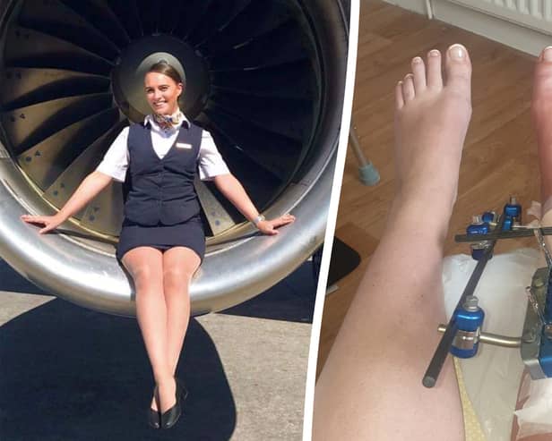 Air hostess Eden Garrity in 2019, before the accident, an during her recovery 