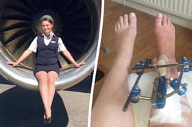 Air hostess Eden Garrity in 2019, before the accident, an during her recovery 