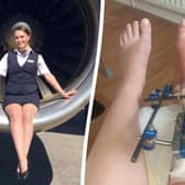 Air hostess Eden Garrity in 2019, before the accident, an during her recovery 