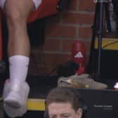 Bruno Fernandes was pictured with an ice pack around his left ankle