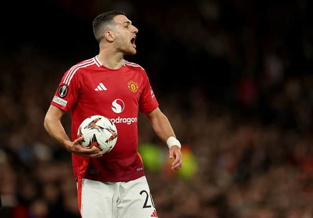 Dalot did not start against Wolves and should come back into the line up this weekend.