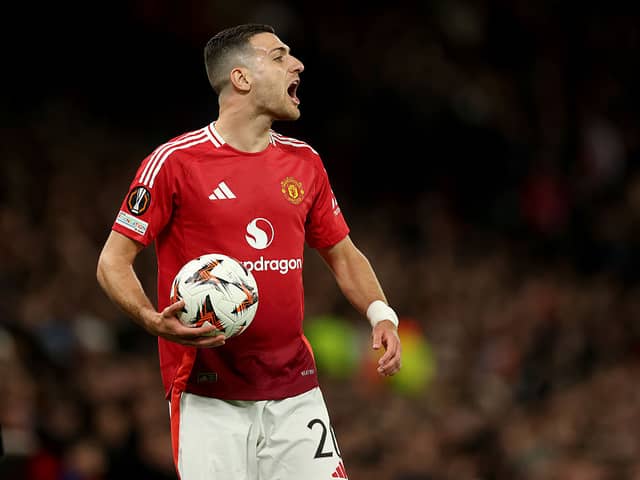 Dalot did not start against Wolves and should come back into the line up this weekend.