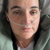 Katie Cooper was initially told her aches and pains were due to a bug she’d caught while on holiday, only to later discover she actually had stage four skin cancer