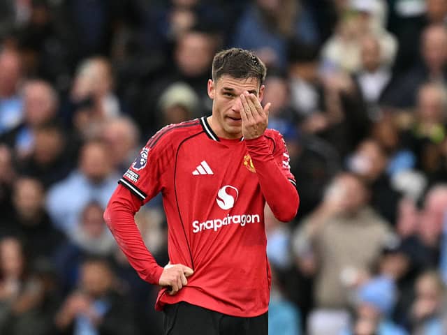 Ugarte was terrible against Aston Villa but is likely to keep his place in midfield.