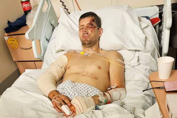 Mike Stubbs has been left with life-changing injuries after a horror hit-and-run during a lunchtime jog.
