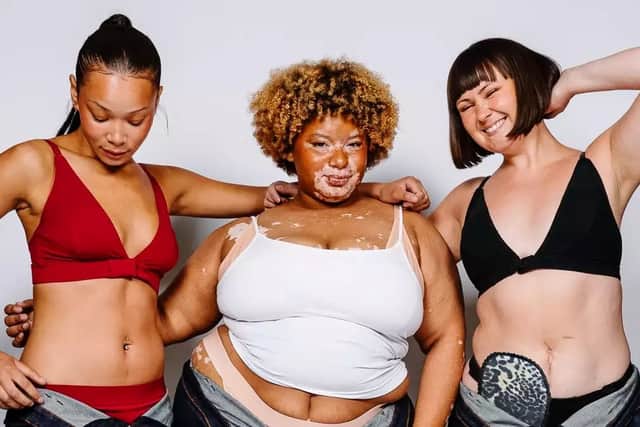 Manchester's Disability Pride Catwalk is a giant leap forward
