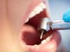 The Greater Manchester borough which lost one in four NHS dentists in a year