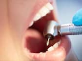There are 25 per cent fewer NHS dentists in Bolton than a year ago. Photo: Getty Images