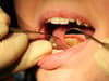 Figures reveal pandemic's huge impact on dental care in Oldham
